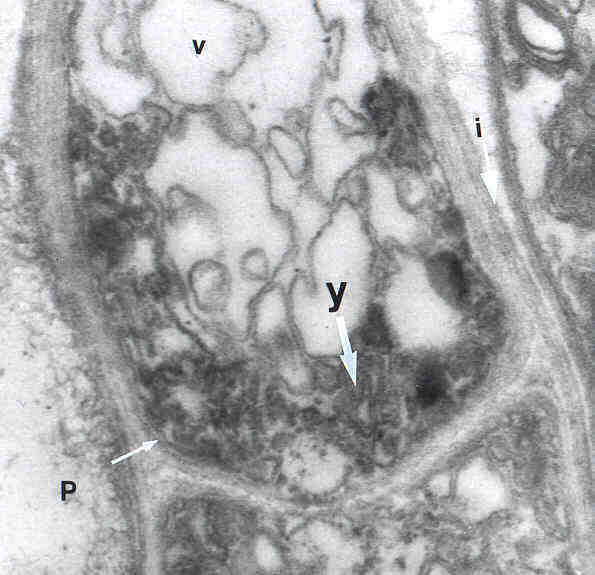 EM-Aufnahme einer tote Hyphe von Serpula lacrymans