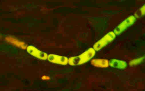 Überdauerungssporen des Hausschwammes