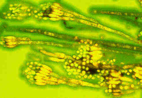 Conidien entwickeln sich am Ende von speziellen Hyphen, den Conidientr&auml;gern