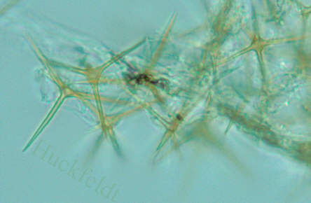 Setae des Sternsetenpilzes