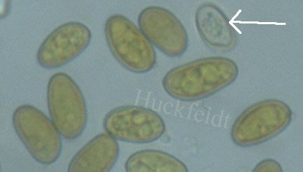 Sporen des Kellerschwammes