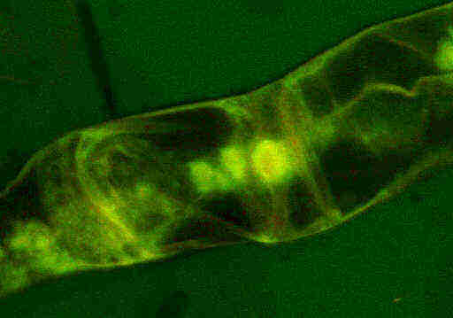  Gef&auml;&szlig;hyphen mit Knoten