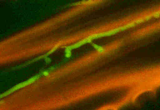 gef&auml;rbte Substrathyphen des Echten Hausschwammes