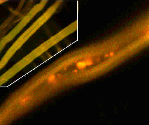 Faserhyphen des Hausschwammes