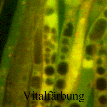 Vitalf&auml;rbung von lebenden Hyphen